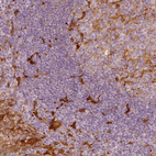 Anti-FSCN1 Antibody