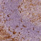 Immunohistochemical staining of human tonsil shows strong cytoplasmic positivity in non-germinal center cells.