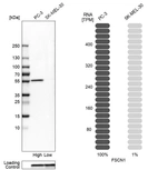 Western blot analysis in human cell lines PC-3 and SK-MEL-30 using Anti-FSCN1 antibody. Corresponding FSCN1 RNA-seq data are presented for the same cell lines. Loading control: Anti-GAPDH.