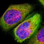 Immunofluorescent staining of human cell line A-431 shows localization to cytosol.