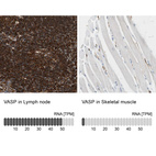 Anti-VASP Antibody