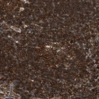 Immunohistochemical staining of human lymph node shows strong cytoplasmic positivity in lymphocytes.