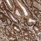 Immunohistochemical staining of human stomach shows strong membranous positivity in glandular cells.