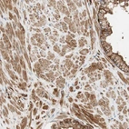 Immunohistochemical staining of human prostate shows moderate cytoplasmic positivity in smooth muscle cells.