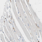 Immunohistochemical staining of human skeletal muscle shows no positivity in myocytes as expected.