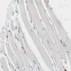 Immunohistochemical staining of human skeletal muscle shows no positivity in myocytes as expected.