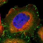Immunofluorescent staining of human cell line A-431 shows localization to plasma membrane, cytosol & focal adhesion sites.
