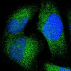 Immunofluorescent staining of human cell line U-2 OS shows localization to cytosol.