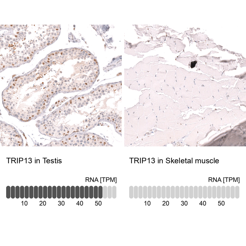 Anti-TRIP13 Antibody