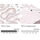 Anti-TRIP13 Antibody
