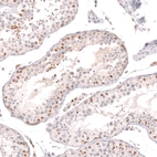 Immunohistochemical staining of human testis shows moderate nuclear positivity in a subset of cells in seminiferous ducts.