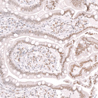 Immunohistochemical staining of human small intestine shows moderate nuclear positivity in glandular cells.