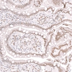 Immunohistochemical staining of human small intestine shows moderate nuclear positivity in glandular cells.