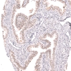 Immunohistochemical staining of human fallopian tube shows moderate nuclear positivity in glandular cells.