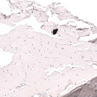 Immunohistochemical staining of human skeletal muscle shows no positivity in myocytes as expected.