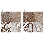 Anti-GALT Antibody