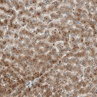 Immunohistochemical staining of human liver shows strong cytoplasmic positivity in hepatocytes.