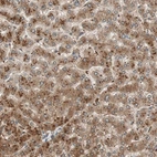 Immunohistochemical staining of human liver shows strong cytoplasmic positivity in hepatocytes.