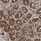 Immunohistochemical staining of human gastrointestinal shows strong cytoplasmic positivity in glandular cells.