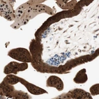 Immunohistochemical staining of human placenta shows strong cytoplasmic positivity in trophoblastic cells.