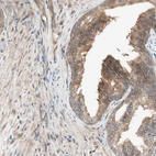 Immunohistochemical staining of human prostate shows moderate cytoplasmic positivity in glandular cells.