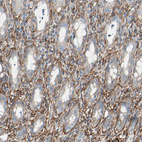 Immunohistochemical staining of human rectum shows strong membranous positivity in stromal cells.