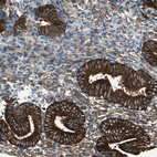 Immunohistochemical staining of human endometrium shows strong membranous positivity in glandular cells.