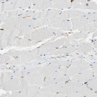 Immunohistochemical staining of human skeletal muscle shows no positivity in myocytes as expected.