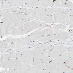 Immunohistochemical staining of human skeletal muscle shows no positivity in myocytes as expected.