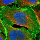 Immunofluorescent staining of human cell line U-2 OS shows localization to plasma membrane & cell junctions.