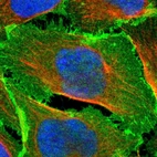 Immunofluorescent staining of human cell line U-2 OS shows localization to plasma membrane & cell junctions.