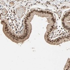 Anti-ZBTB33 Antibody