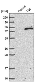 Western blot analysis in control (vector only transfected HEK293T lysate) and TEC over-expression lysate (Co-expressed with a C-terminal myc-DDK tag (~3.1 kDa) in mammalian HEK293T cells, LY418830).