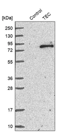 Western blot analysis in control (vector only transfected HEK293T lysate) and TEC over-expression lysate (Co-expressed with a C-terminal myc-DDK tag (~3.1 kDa) in mammalian HEK293T cells, LY418830).