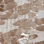 Immunohistochemical staining of human skeletal muscle shows moderate cytoplasmic positivity in myocytes.