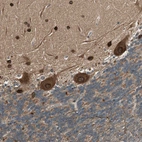 Immunohistochemical staining of human cerebellum shows moderate to strong cytoplasmic positivity in Purkinje cells.
