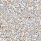 Immunohistochemical staining of human liver shows very weak cytoplasmic positivity in hepatocytes as expected.