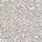 Immunohistochemical staining of human liver shows very weak cytoplasmic positivity in hepatocytes as expected.