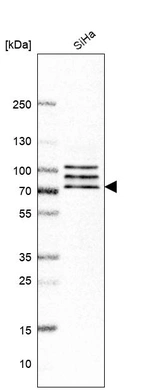 Western blot analysis in human cell line SiHa.