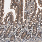 Anti-SDSL Antibody