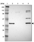 Lane 1: Marker [kDa] 220, 112, 84, 47, 32, 26, 17_br/_Lane 2: Human cell line RT-4_br/_Lane 3: Human cell line U-251MG sp_br/_Lane 4: Human plasma (IgG/HSA depleted)_br/_Lane 5: Human liver tissue