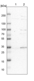 Lane 1: NIH-3T3 cell lysate (Mouse embryonic fibroblast cells)_br/_Lane 2: NBT-II cell lysate (Rat Wistar bladder tumour cells)