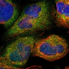 Immunofluorescent staining of human cell line U-2 OS shows localization to cytosol.