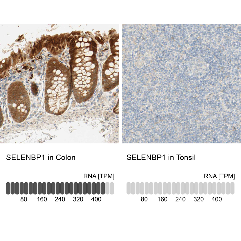 Anti-SELENBP1 Antibody