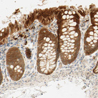 Immunohistochemical staining of human colon shows strong cytoplasmic positivity in glandular cells.