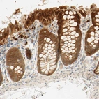 Immunohistochemical staining of human colon shows strong cytoplasmic positivity in glandular cells.