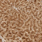 Immunohistochemical staining of human liver shows strong cytoplasmic and nuclear positivity in hepatocytes.