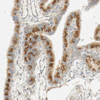 Anti-SELENBP1 Antibody