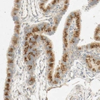 Immunohistochemical staining of human Fallopian tube shows weak to moderate nuclear positivity in glandular cells.