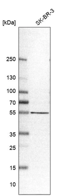 Western blot analysis in human cell line SK-BR-3.